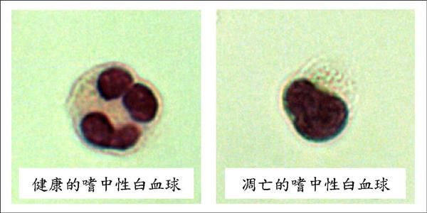 癮科學：劇烈運動有損免疫力，規律中度運動最佳